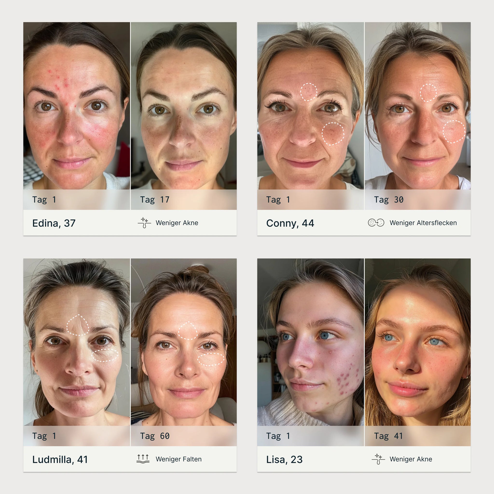 Starter-Set: 6-in-1-Lichttherapie Stab mit Renew & Clear Serum T01